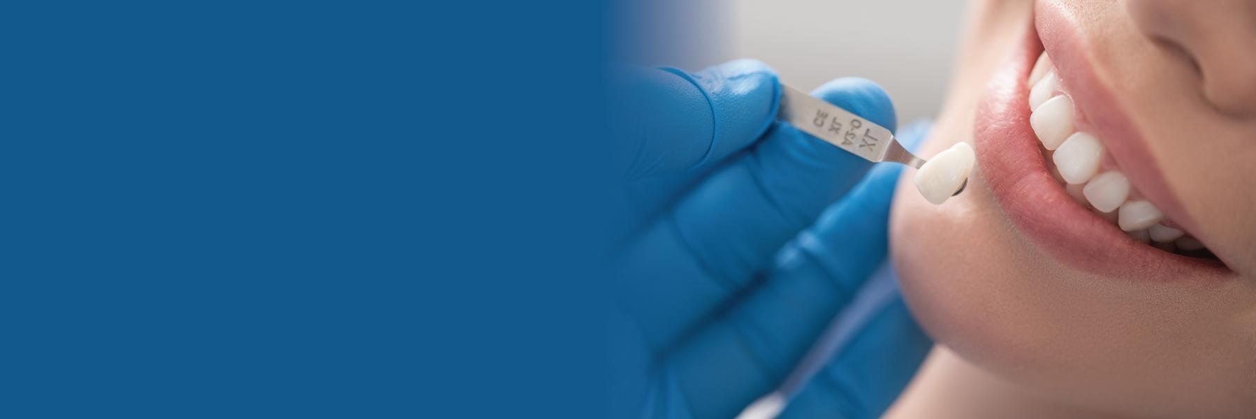 Invisalign | Dentist